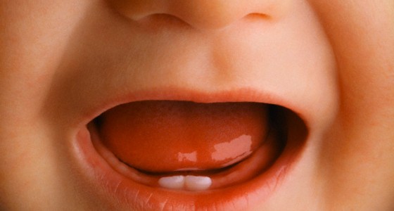 Pirmieji vaiko dantukai – pieniniai dantukai
